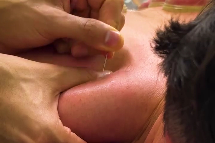 Cảm Giác Thật Đã Khi Hết Đau Cổ