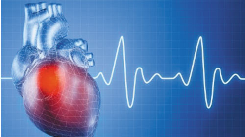 Việc căng thẳng có liên quan đến những cơn đau tim - Stress gene linked to heart attacks
